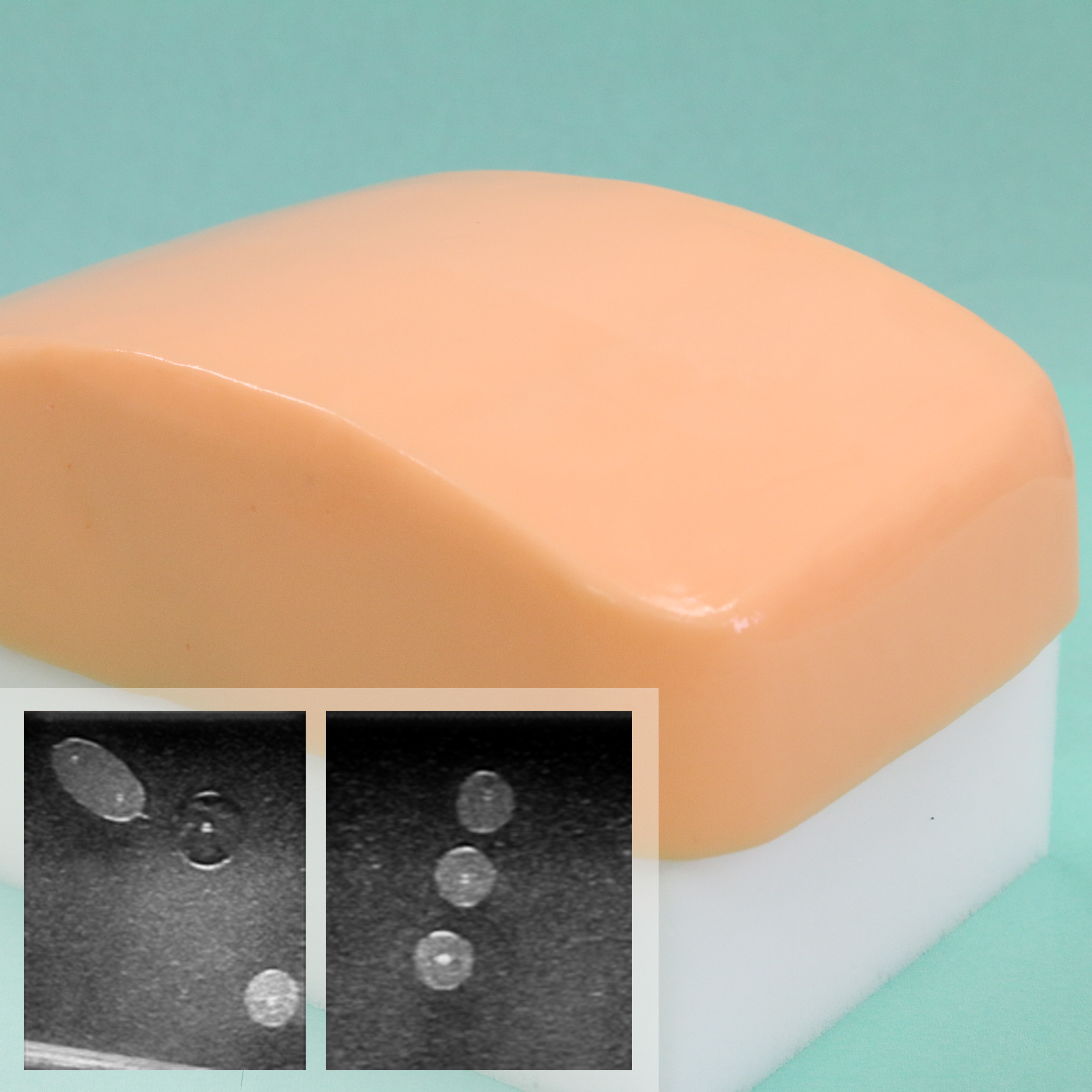 神経ブロックモデル