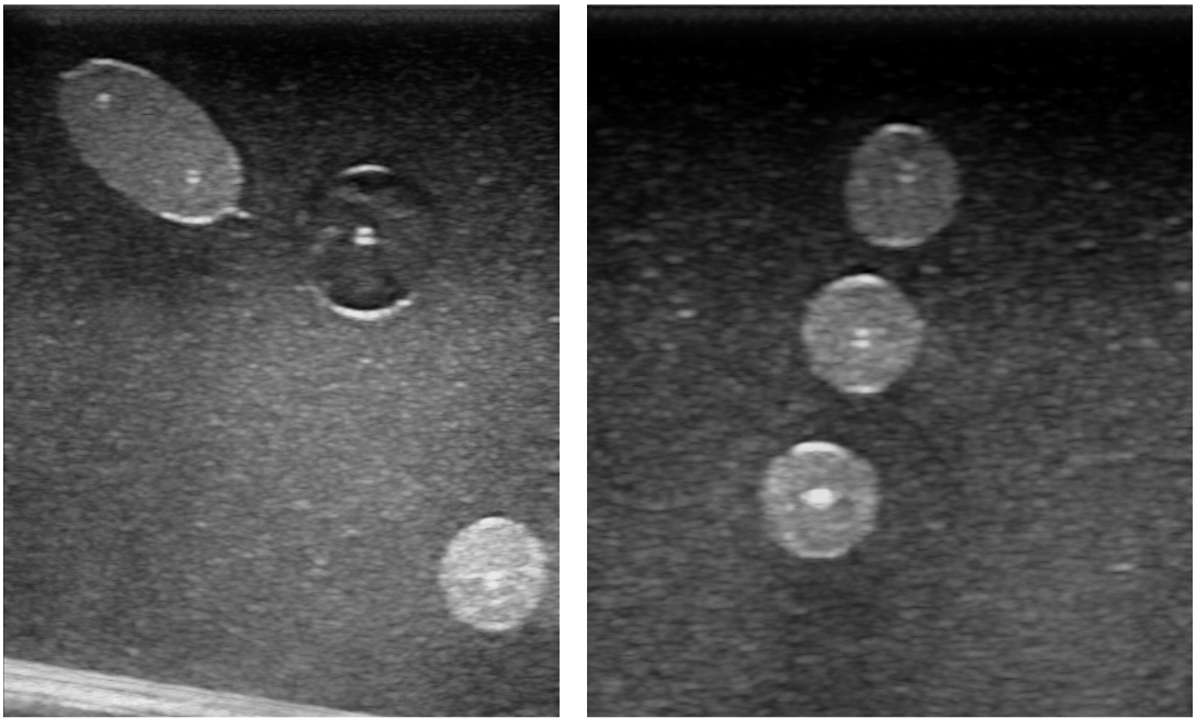 神経ブロックモデル