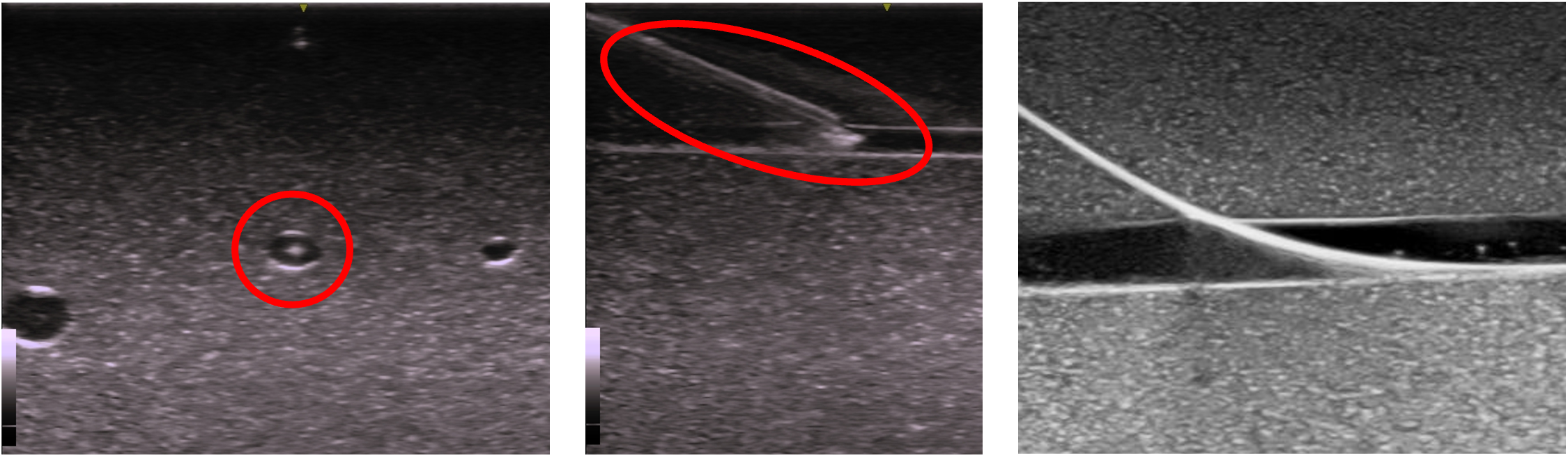 血管穿刺モデル